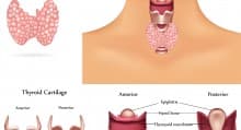 Hypothyroidism Checklist